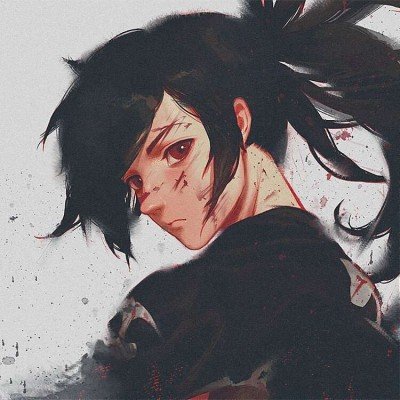 女子剖腹产后突发脑梗致双眼失明